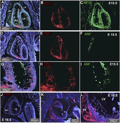 Imprinted Gene Expression and Function of the Dopa Decarboxylase Gene in the Developing Heart